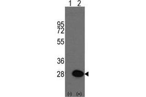 Western blot analysis of HSPB1(arrow) using rabbit polyclonal HSPB1 Antibody (HSP27 抗体  (Ser83))