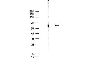 anti-Doublesex and Mab-3 Related Transcription Factor 2 (DMRT2) antibody