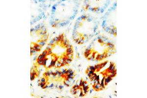 Anti-Alkaline Phosphatase antibody, IHC(P) IHC(P): Rat Small Intestine Tissue (ALPL 抗体  (N-Term))