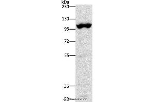 Western blot analysis of Mouse heart tissue, using TRPM5 Polyclonal Antibody at dilution of 1:1200