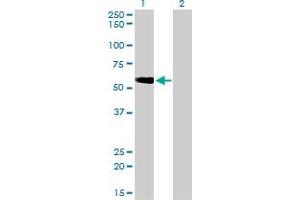 Western Blotting (WB) image for anti-Target of Myb 1 (TOM1) (AA 394-492) antibody (ABIN599110) (TOM1 抗体  (AA 394-492))