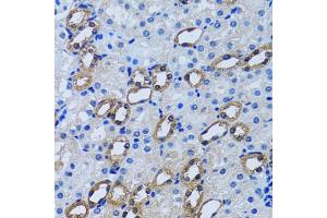 Immunohistochemistry of paraffin-embedded rat kidney using IMPA1 antibody (ABIN2563424) at dilution of 1:100 (40x lens). (IMPA1 抗体)