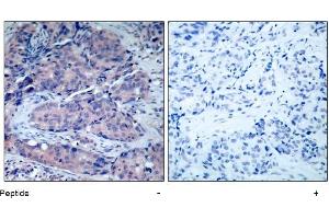 Image no. 1 for anti-Mitogen-Activated Protein Kinase Kinase 4 (MAP2K4) (Thr261) antibody (ABIN197323) (MAP2K4 抗体  (Thr261))