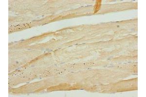 Immunohistochemistry of paraffin-embedded human skeletal muscle tissue using ABIN7173467 at dilution of 1:100 (TRIM55 抗体  (AA 101-300))