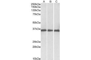ABIN1590035 (0. (MDH1 抗体  (AA 211-223))