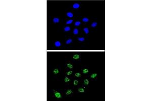Confocal immunofluorescent analysis of DKC1 Antibody (Center) (ABIN651670 and ABIN2840353) with 293 cell followed by Alexa Fluor® 488-conjugated goat anti-rabbit lgG (green). (DKC1 抗体  (AA 185-213))