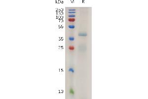 R-Spondin 1 (RSPO1) (AA 21-263) protein (His tag)