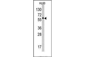 Image no. 1 for anti-Testis-Specific Kinase 2 (TESK2) (Middle Region) antibody (ABIN360162) (TESK2 抗体  (Middle Region))
