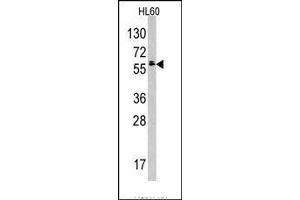 Image no. 1 for anti-Testis-Specific Kinase 2 (TESK2) (Middle Region) antibody (ABIN360162)