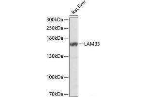Western blot analysis of extracts of Rat liver using LAMB3 Polyclonal Antibody at dilution of 1:1000. (Laminin beta 3 抗体)