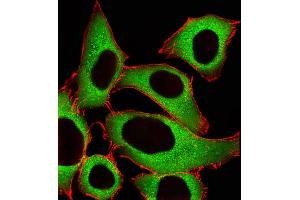 Fluorescent image of A549 cells stained with ALDH1A1 Antibody (Center) (ABIN1945086 and ABIN2838551). (ALDH1A1 抗体  (AA 306-339))