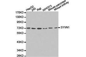 Western Blotting (WB) image for anti-Synovial Apoptosis Inhibitor 1, Synoviolin (SYVN1) antibody (ABIN1875011) (SYVN1 抗体)