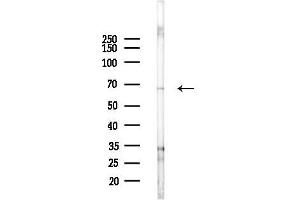 Western blot analysis of lysates from EC304 cells(starvation 24h treatment), using ENC1 Antibody at 1/1000 dilution.