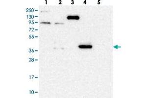 Western blot analysis of Lane 1: RT-4, Lane 2: U-251 MG, Lane 3: Human Plasma, Lane 4: Liver, Lane 5: Tonsil with PDSS1 polyclonal antibody .