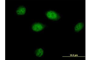 Immunofluorescence of purified MaxPab antibody to BAT3 on HeLa cell. (BAT3 抗体  (AA 1-1126))