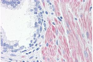 Human Prostate: Formalin-Fixed, Paraffin-Embedded (FFPE) (ALOX15 抗体  (AA 1-663))