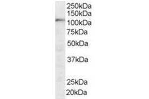 Image no. 1 for anti-Squamous Cell Carcinoma Antigen Recognized By T Cells (SART1) (N-Term) antibody (ABIN374288) (SART1 抗体  (N-Term))