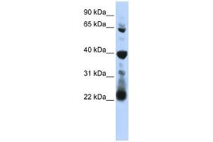 RPUSD3 antibody used at 1 ug/ml to detect target protein. (RPUSD3 抗体  (Middle Region))