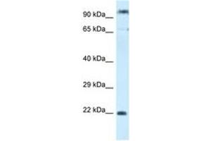 Image no. 1 for anti-Polymerase (RNA) III (DNA Directed) Polypeptide G (32kD)-Like (POLR3GL) (C-Term) antibody (ABIN6747444) (POLR3GL 抗体  (C-Term))
