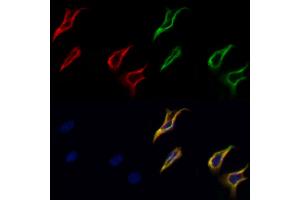 ABIN6264310 and ABIN6277668 staining Hela cells by IF/ICC. (PLTP 抗体  (Internal Region))