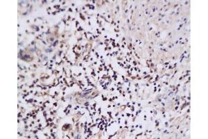 Immunohistochemistry (Paraffin-embedded Sections) (IHC (p)) image for anti-Nuclear Apoptosis Inducing Factor 1 (NAIF1) (AA 3-85) antibody (ABIN668796) (NAIF1 抗体  (AA 3-85))