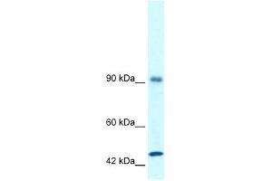 WB Suggested Anti-RBM10 Antibody Titration: 1. (RBM10 抗体  (N-Term))