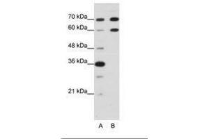 Image no. 2 for anti-Doublesex and Mab-3 Related Transcription Factor 2 (DMRT2) (N-Term) antibody (ABIN203207) (DMRT2 抗体  (N-Term))