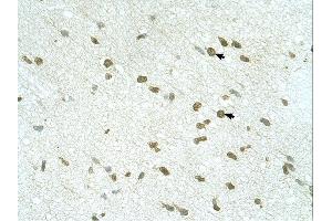 RNF168 antibody was used for immunohistochemistry at a concentration of 4-8 ug/ml. (RNF168 抗体  (C-Term))
