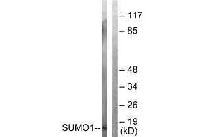 Western blot analysis of extracts from 293 cells, using Sumo1 antibody. (SUMO1 抗体  (N-Term))