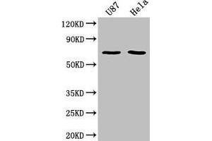 Western Blot Positive WB detected in: U87 whole cell lysate, Hela whole cell lysate All lanes: SUSD5 antibody at 1:2000 Secondary Goat polyclonal to rabbit IgG at 1/50000 dilution Predicted band size: 69 kDa Observed band size: 69 kDa (SUSD5 抗体  (AA 46-287))