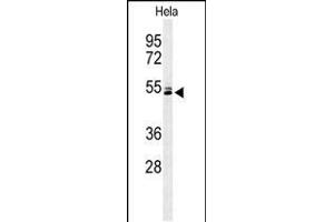 Western blot analysis of K2C78 Antibody (Center) (ABIN653813 and ABIN2843087) in Hela cell line lysates (35 μg/lane). (Keratin 78 抗体  (AA 176-203))