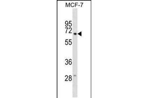 Western blot analysis in MCF-7 cell line lysates (35ug/lane). (gGT6 抗体  (N-Term))