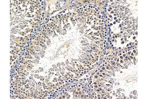 ABIN7095903 and ABIN7099965 at 1/100 staining rat testis tissue by IHC-P.