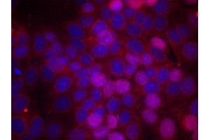 Immunofluorescence staining of methanol-fixed MCF cells using Phospho-ESR1-S106 antibody. (Estrogen Receptor alpha 抗体  (pSer106))