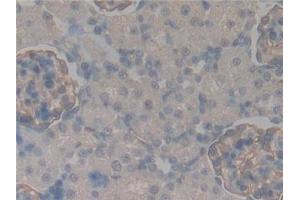 Detection of PODXL in Rat Kidney Tissue using Polyclonal Antibody to Podocalyxin (PODXL) (PODXL 抗体  (AA 153-386))