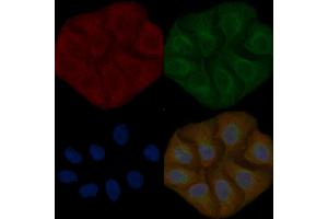ASPRV1 Mouse Monoclonal Antibody staining Hela cells by IF/ICC. (ASPRV1 抗体)