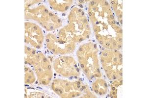 Immunohistochemistry of paraffin-embedded human kidney using TRIM69 antibody (ABIN7270998) at dilution of 1:100 (40x lens). (TRIM69 抗体  (AA 1-341))