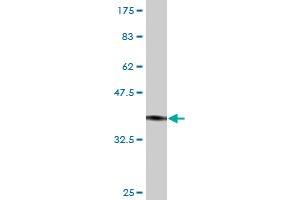 Western Blot detection against Immunogen (37. (VIPR2 抗体  (AA 24-126))