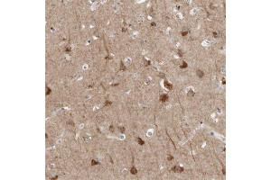 Immunohistochemical staining of human cerebral cortex with TNFRSF11A polyclonal antibody  shows strong cytoplasmic positivity in neurons at 1:500-1:1000 dilution. (TNFRSF11A 抗体)