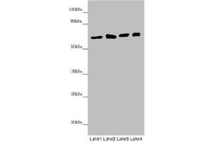 Western blot All lanes: SOCS4 antibody at 4. (SOCS4 抗体  (AA 1-270))