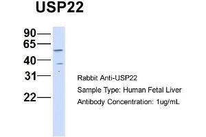 Western Blotting (WB) image for anti-Ubiquitin Specific Peptidase 22 (USP22) (Middle Region) antibody (ABIN2787647)
