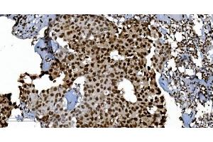 IHC analysis of Ku70 using anti-Ku70 antibody (ABIN7602790).