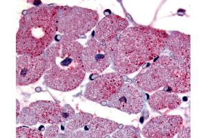 Anti-TPRA1 / GPR175 antibody IHC of human cardiac myocytes. (GPR175 抗体  (Cytoplasmic Domain))