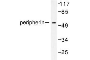 Image no. 1 for anti-Peripherin (PRPH) antibody (ABIN271783) (Peripherin 抗体)