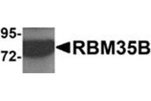 Western blot analysis of RBM35B in human lung tissue lysate with RBM35B antibody at 1 μg/ml. (ESRP2 抗体  (C-Term))
