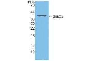 Detection of Recombinant BLVRA, Rat using Polyclonal Antibody to Biliverdin Reductase A (BLVRA) (Biliverdin Reductase 抗体  (AA 10-279))