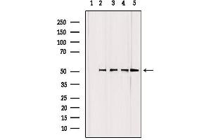 Western blot analysis of extracts from various samples, using GCSc-γ Antibody. (GCLC 抗体  (N-Term))
