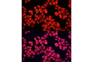 Immunofluorescence analysis of HeLa cells using ALAD antibody (ABIN6129891, ABIN6136749, ABIN6136751 and ABIN6216012) at dilution of 1:100. (ALAD 抗体  (AA 1-330))