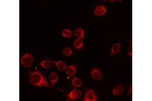 ABIN6276494 staining Hela by IF/ICC. (ALPL 抗体  (Internal Region))