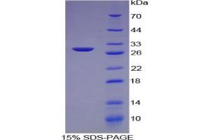 SDS-PAGE (SDS) image for Collagen, Type IV, alpha 2 (COL4A2) protein (ABIN3008888)